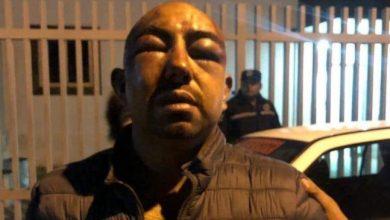 Photo of Tortura y desaparición forzada en Zumpango ¿y la seguridad para cuando Miguel Ángel? VIDEO